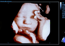Abortion – The Issue That Will Not Die