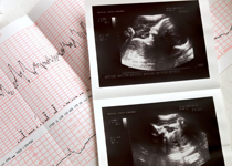 The Power of a Heartbeat